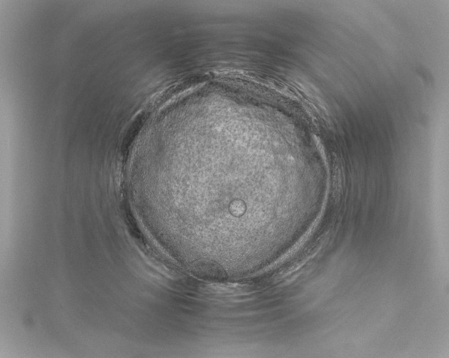 X0000115020367200911161451