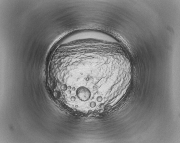 X0000115020392200911161450