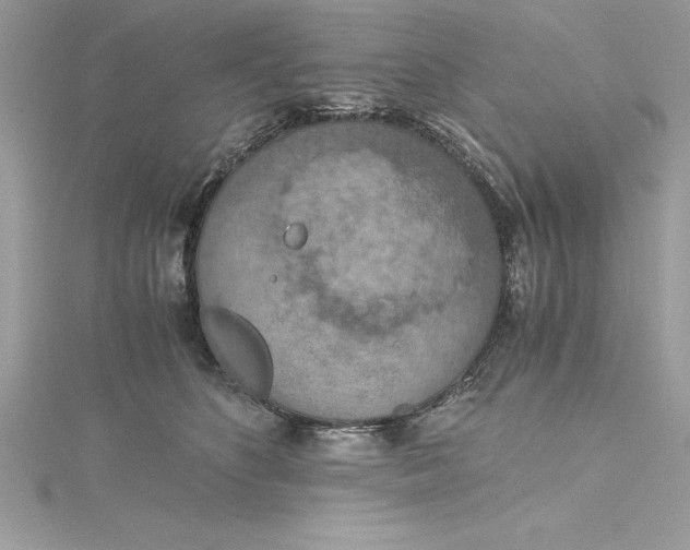 X0000115020516200911161448