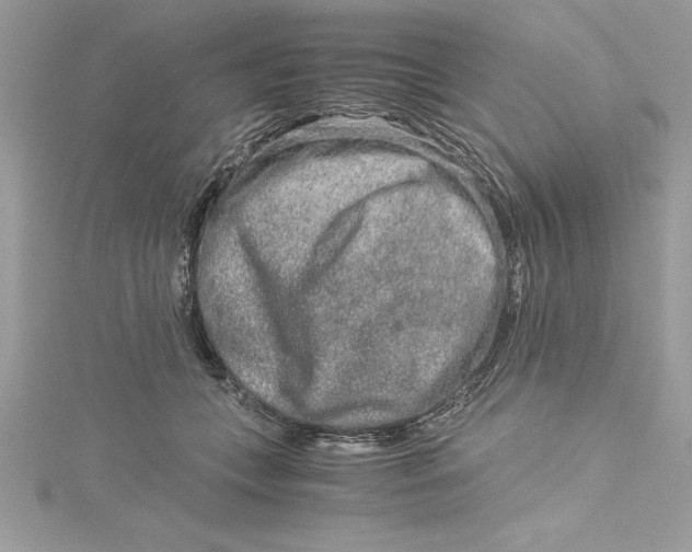 X0000115020559200911161448