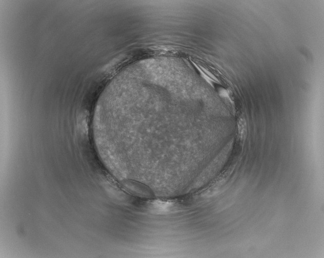 X0000115020570200911161448