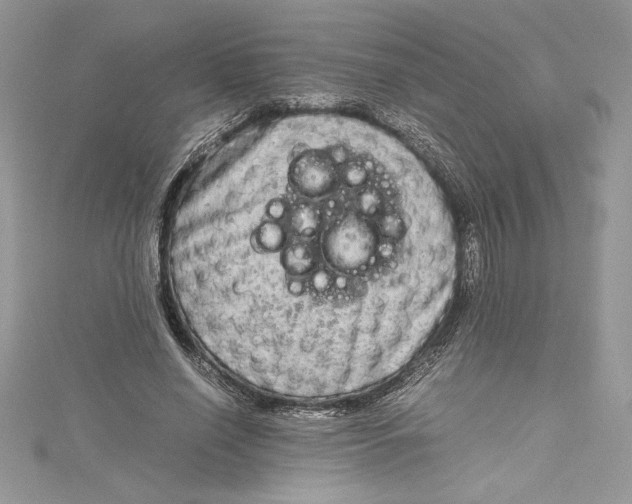 X0000115020638200911161446