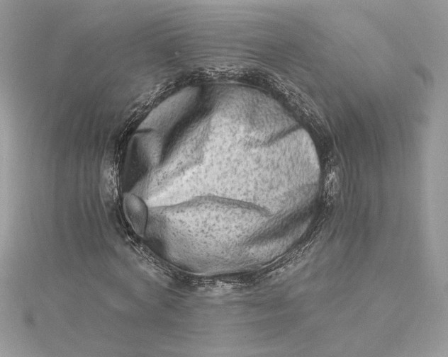 X0000115020772200911161445