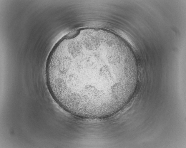 X0000115021087200911161441