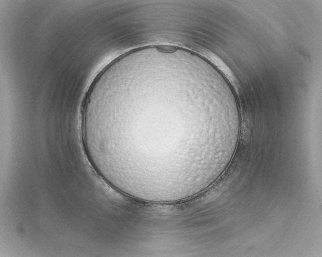 X0000115021096200911161440