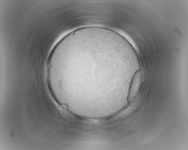 X0000115021101200911161440