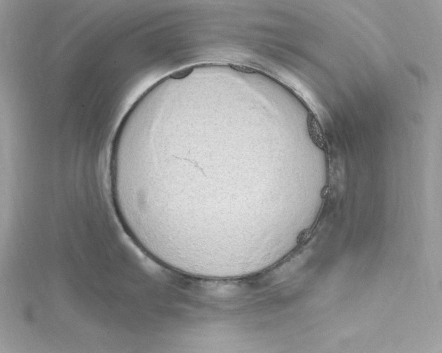 X0000115021103200911161440