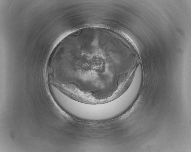 X0000115021141200911161440