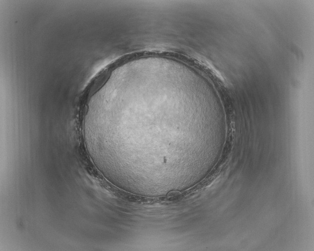 X0000115021256200911161438