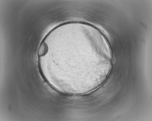 X0000115021287200911161438