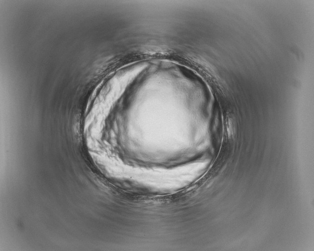 X0000115021396200911161435