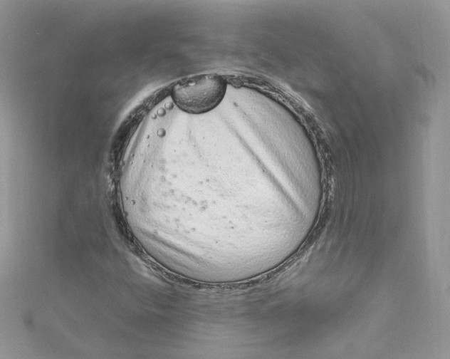 X0000115021400200911161435