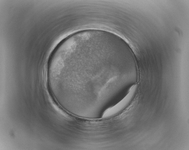 X0000115021515200911161435