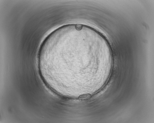 X0000115021517200911161435