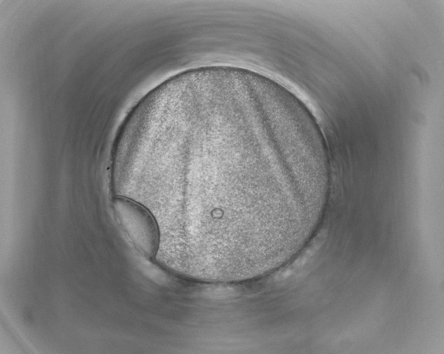 X0000115021525200911161435