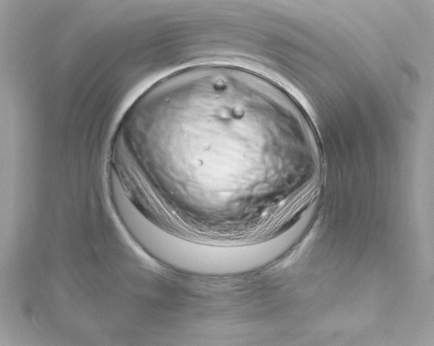 X0000115021533200911161435