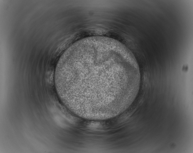 X0000115020177200911231258