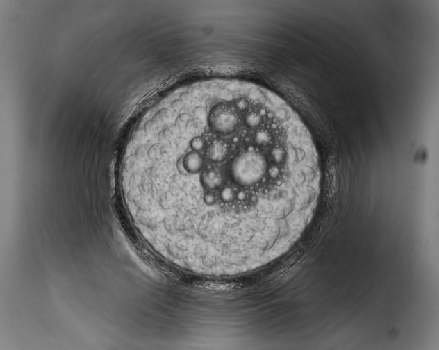 X0000115020638200911231251