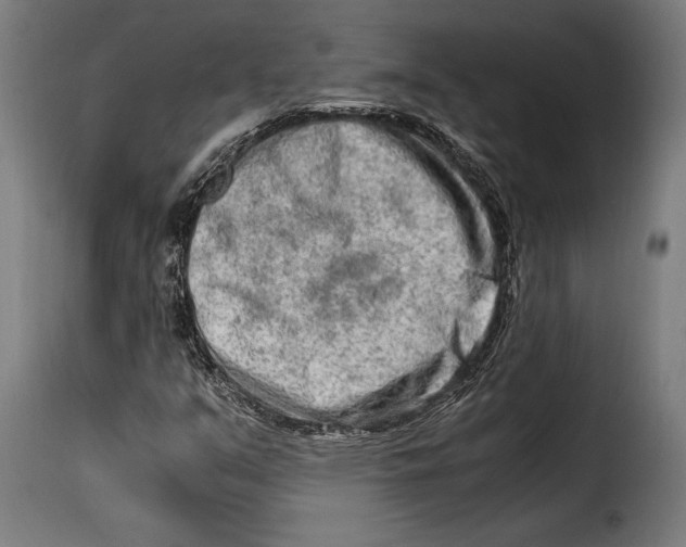 X0000115021351200911231241