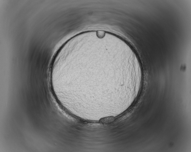 X0000115021517200911231238