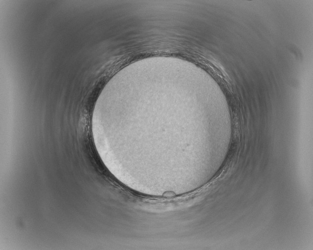 X0000115020029200912071036