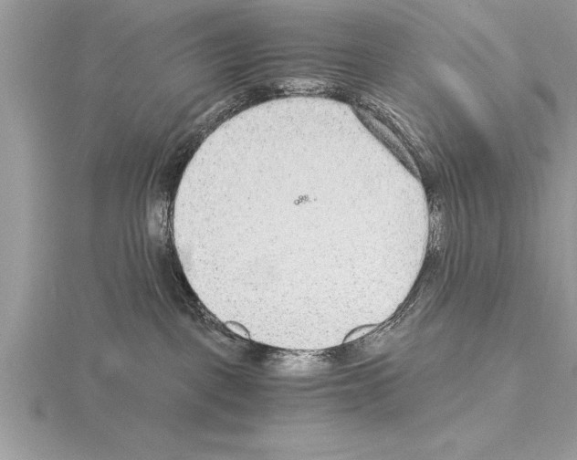 X0000115020093200912071036