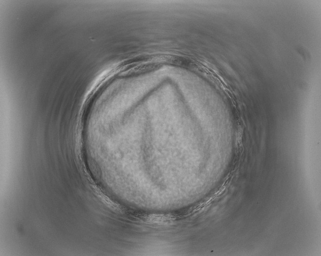 X0000115020101200912071035