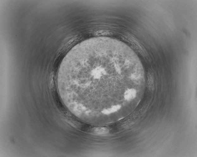 X0000115020169200912071035