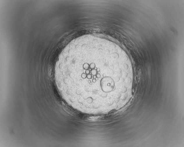 X0000115020178200912071035