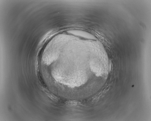 X0000115020339200912071032