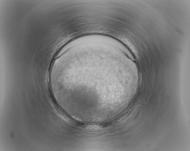 X0000115020397200912071031