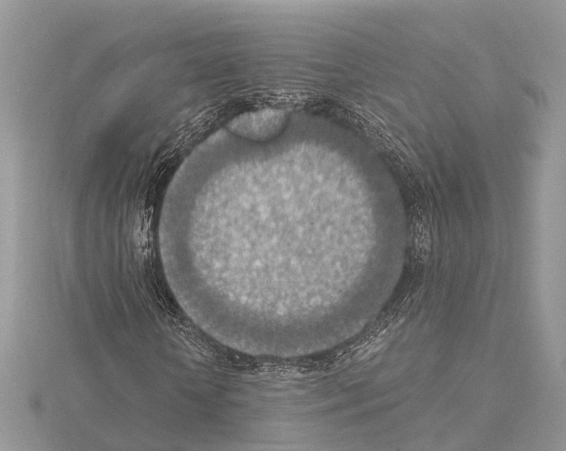 X0000115020818200912071025