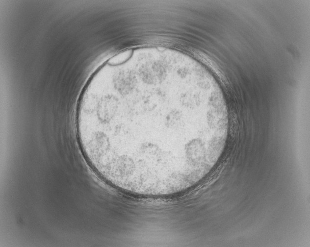 X0000115021087200912071022