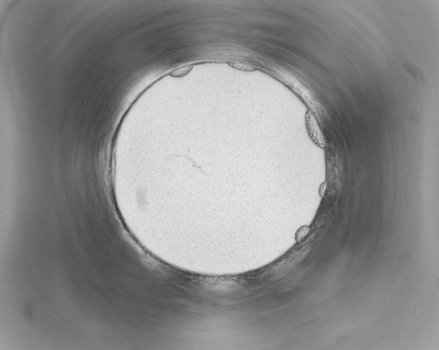 X0000115021103200912071022