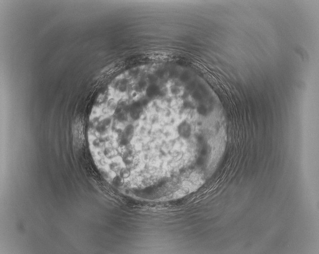 X0000115021106200912071021