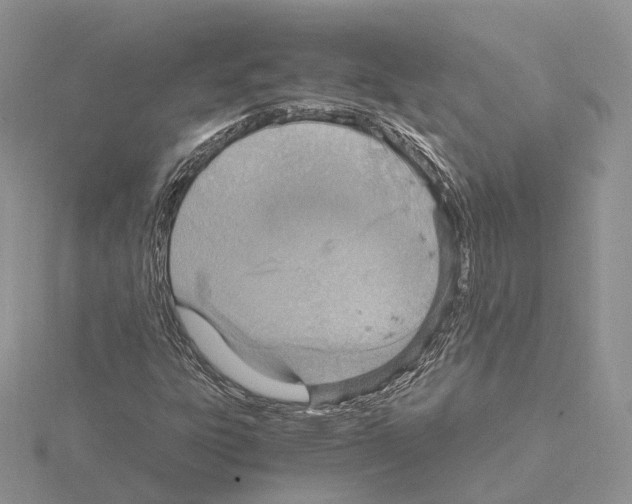 X0000115021303200912071018