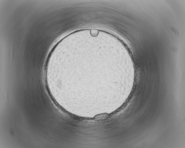 X0000115021517200912071016