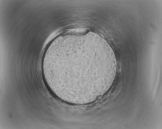 X0000115030004200911161516