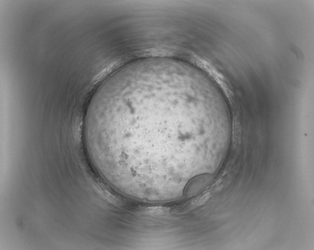 X0000115030153200911161514