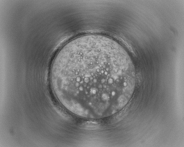 X0000115030159200911161514