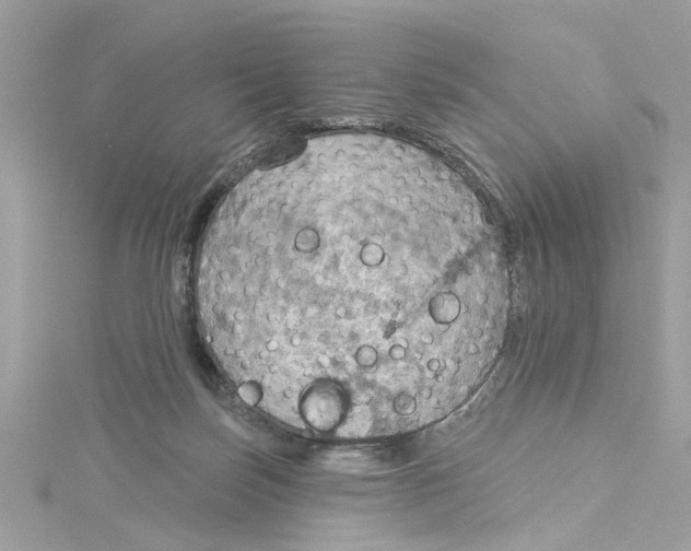 X0000115030171200911161514