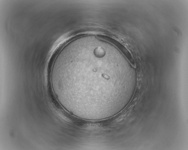 X0000115030296200911161512