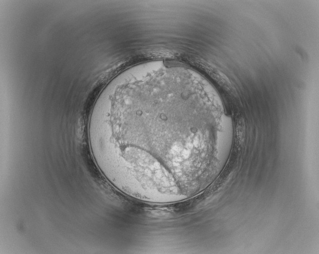 X0000115030359200911161511