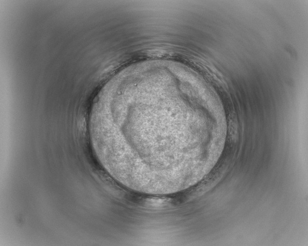 X0000115030375200911161512