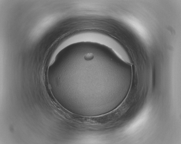 X0000115030387200911161511