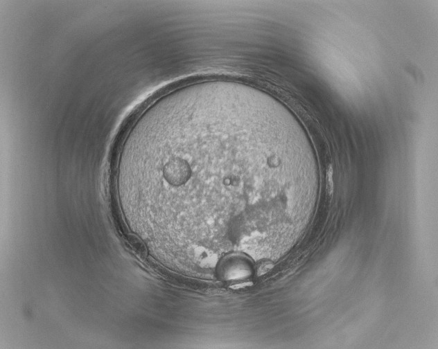 X0000115030388200911161511