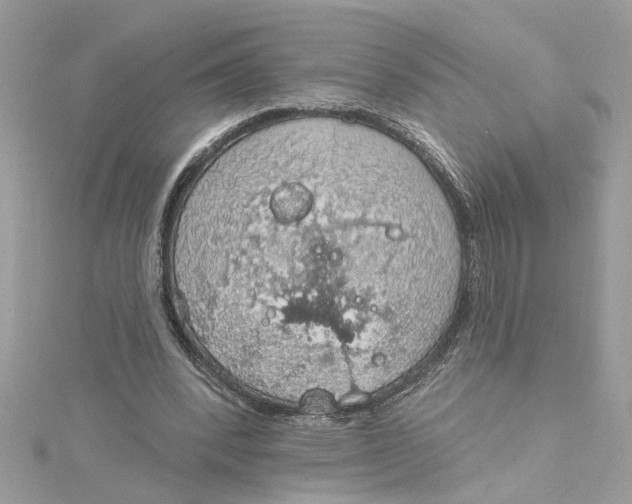 X0000115030392200911161511