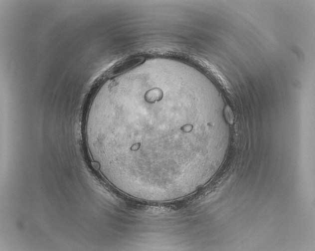 X0000115030399200911161511