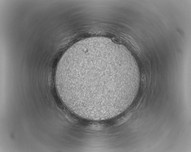 X0000115030416200911161511