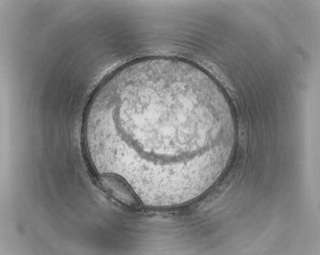 X0000115030434200911161510